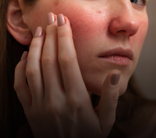 Skin Health